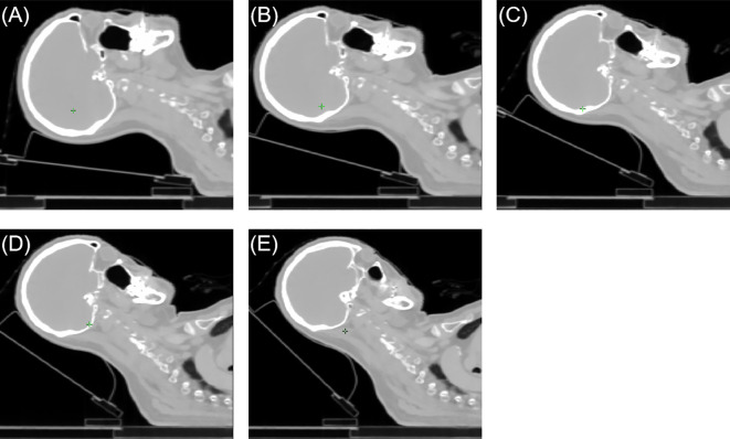 Figure 1