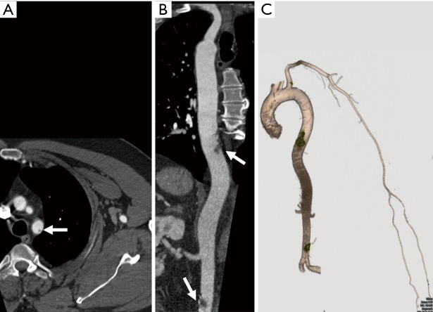 Figure 18