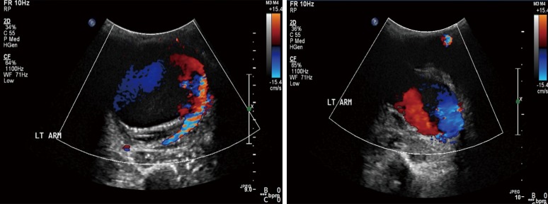 Figure 12