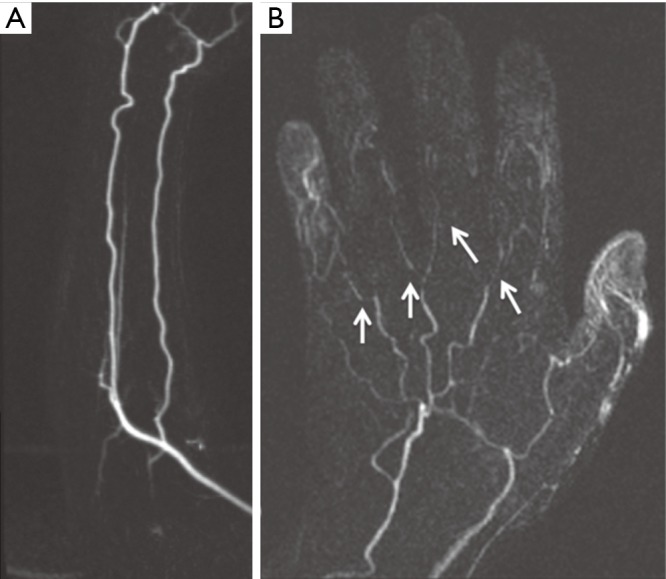 Figure 17