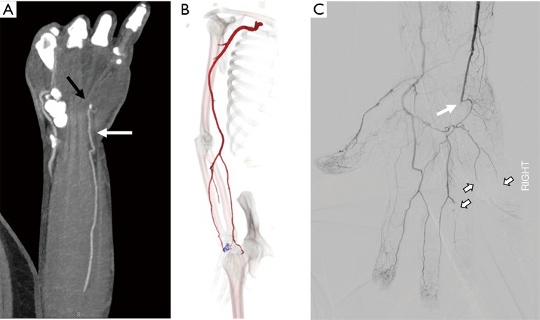 Figure 14