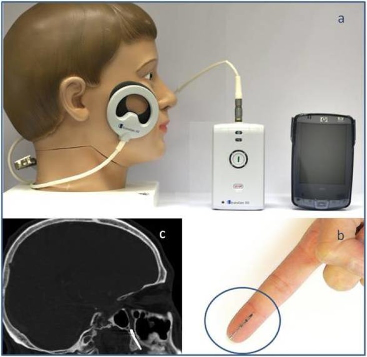 Fig 1