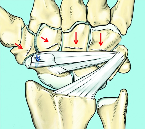 Fig. 4