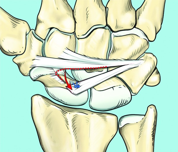 Fig. 5