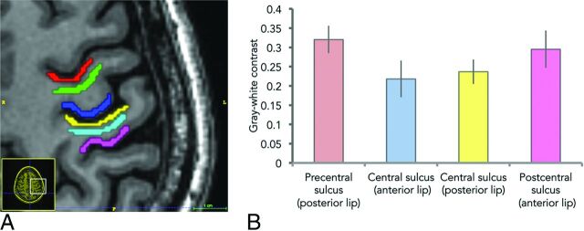 Fig 2.