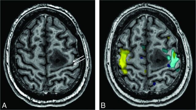 Fig 5.