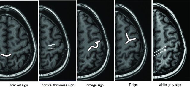 Fig 3.