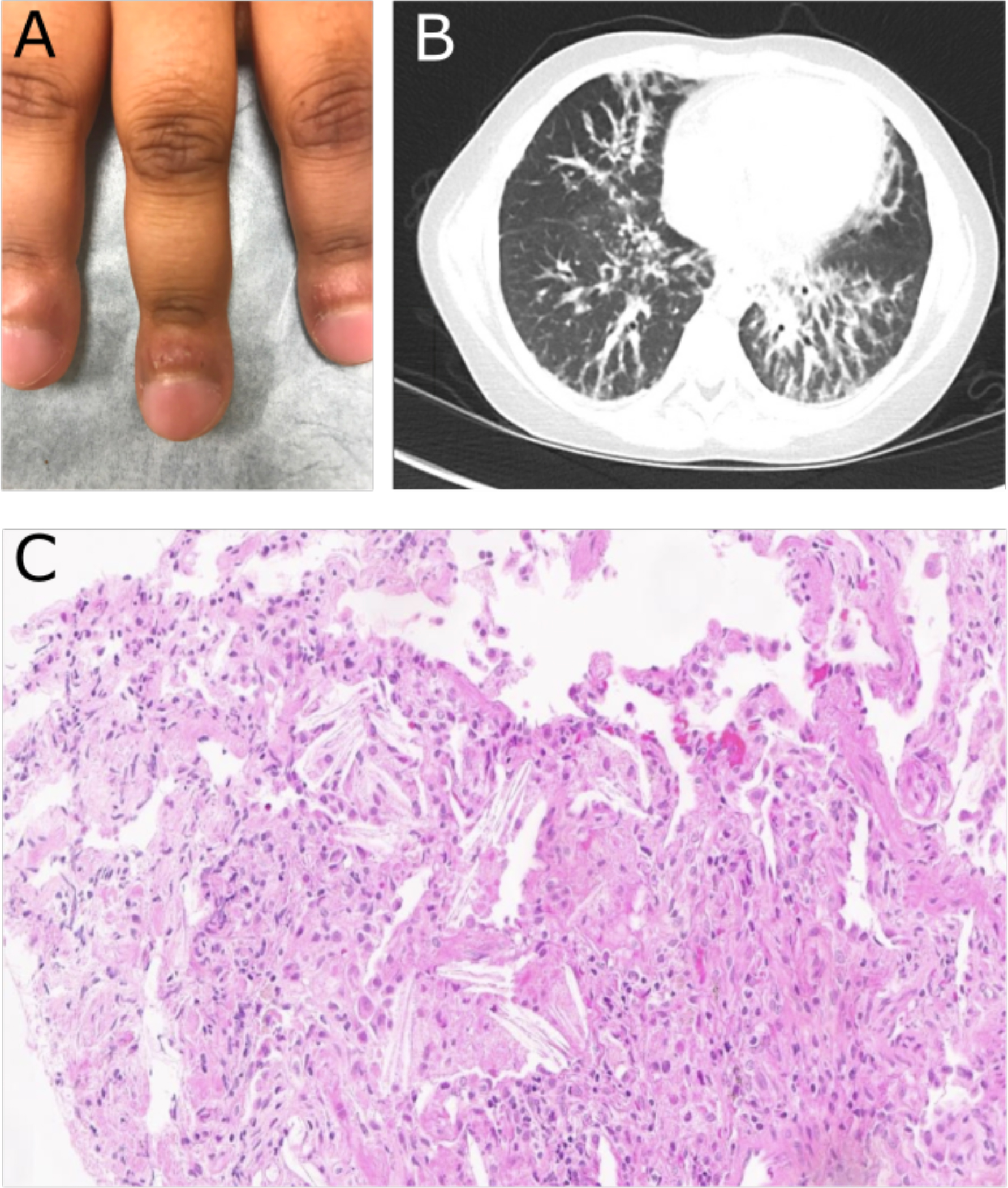 Figure 1: