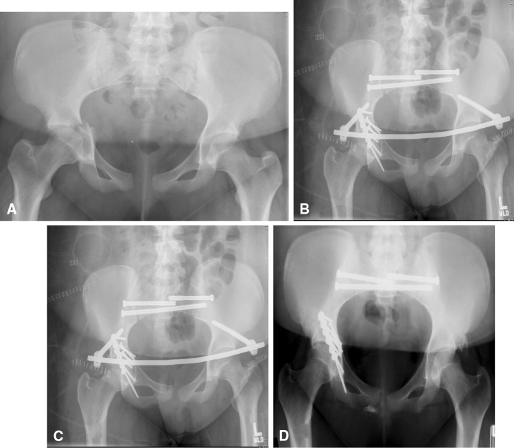 Fig. 2A–D