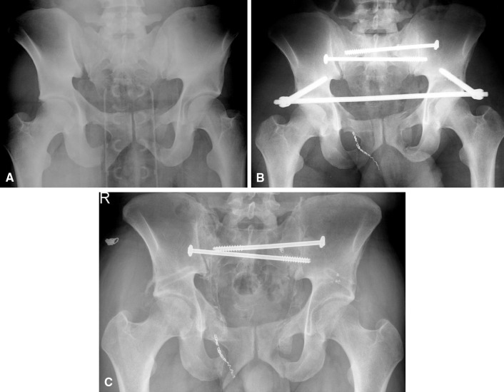 Fig. 1A–C