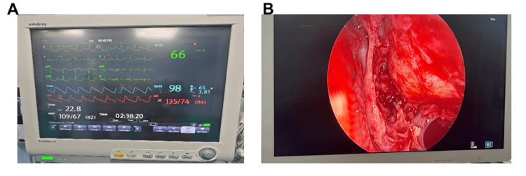 Figure 5