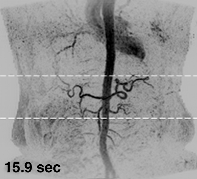 Figure 1c: