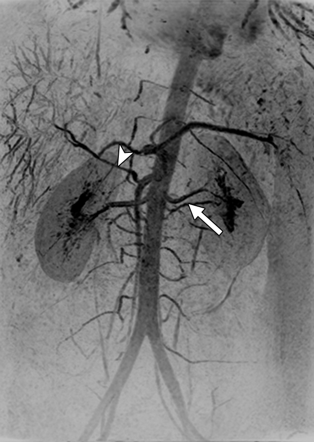 Figure 3e: