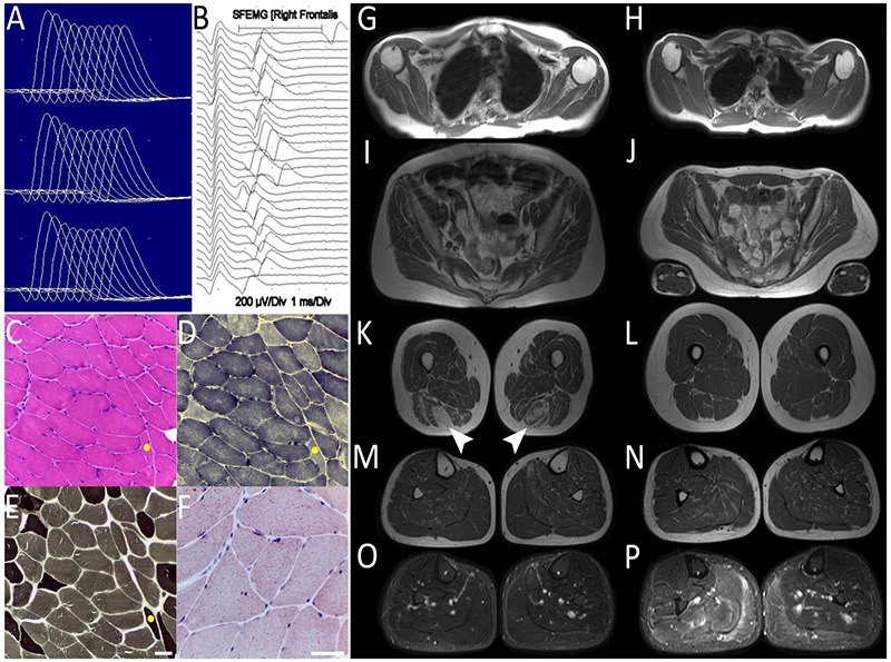 Fig 2.