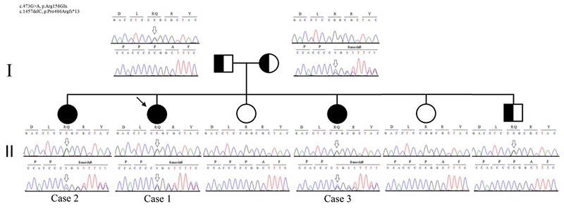 Fig 3.