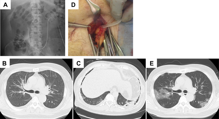 Fig. 1