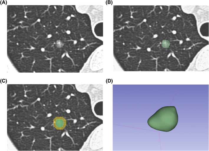 FIGURE 2