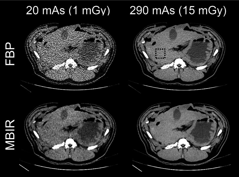 FIG. 4.