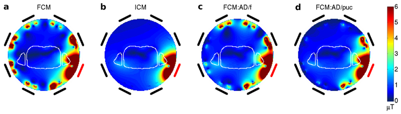 FIG. 3