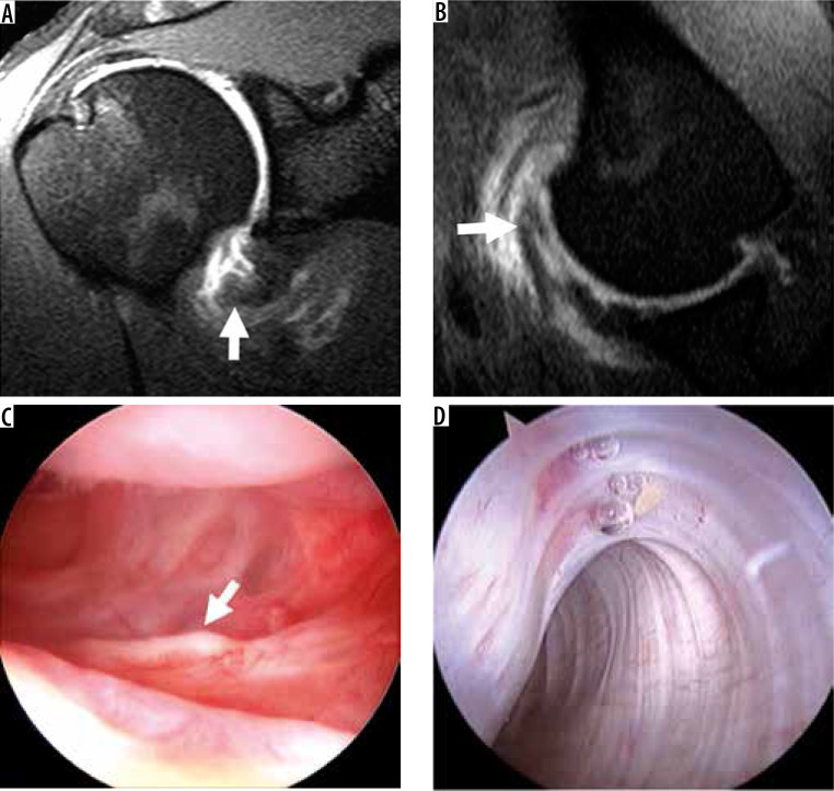 Figure 17