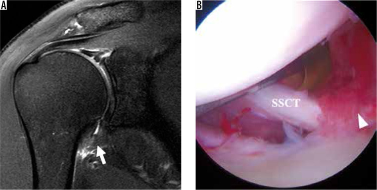 Figure 20