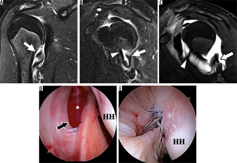 Figure 18