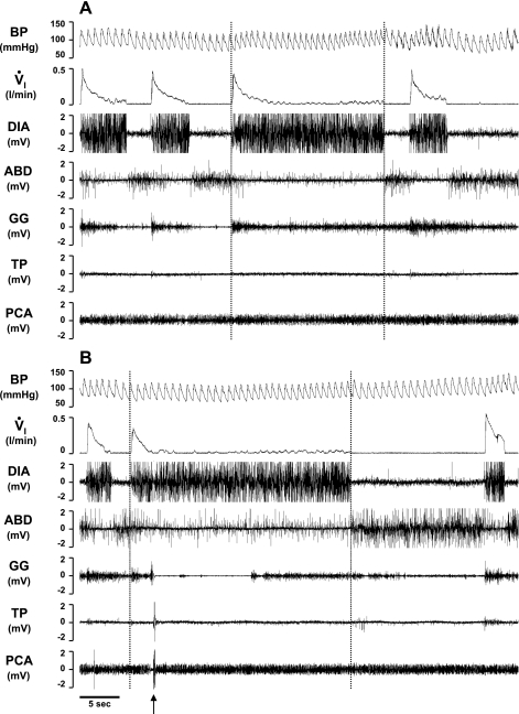 Fig. 11.