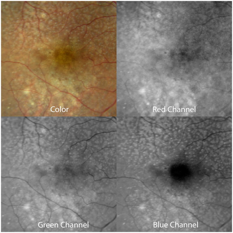 Figure 14