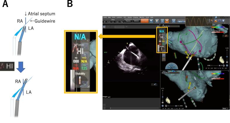 Fig. 2