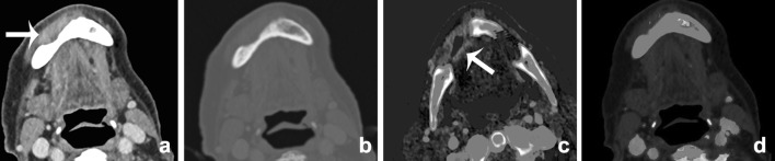 Fig. 13