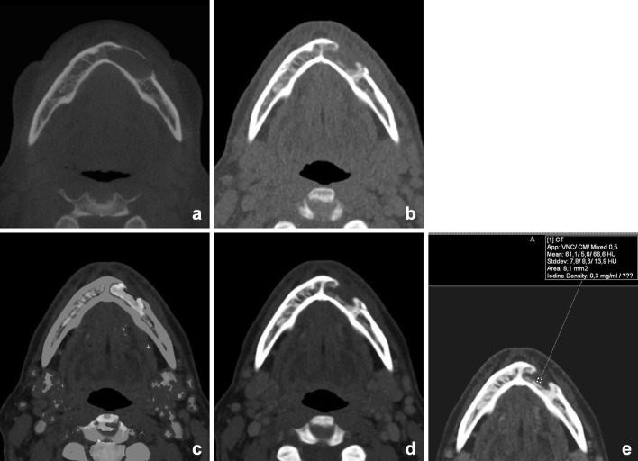 Fig. 11