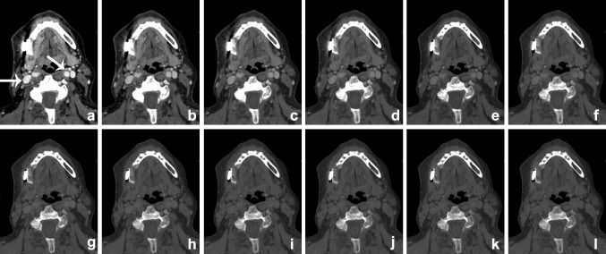 Fig. 4