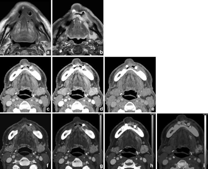 Fig. 9