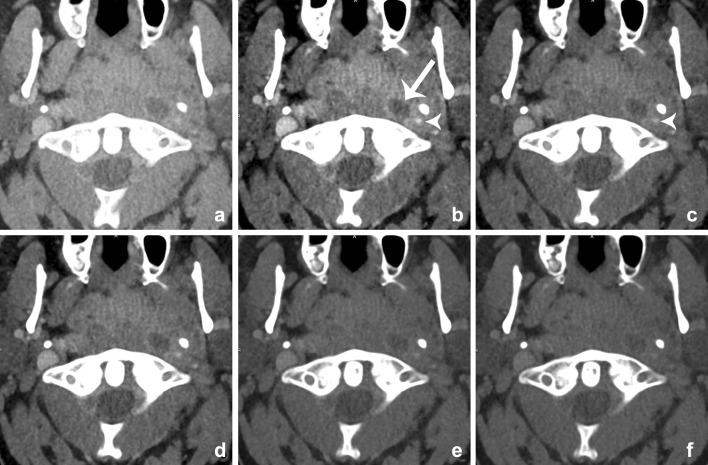 Fig. 18