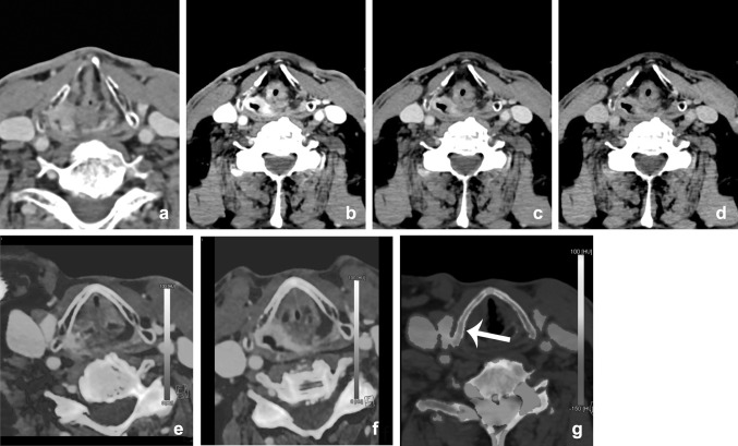 Fig. 10