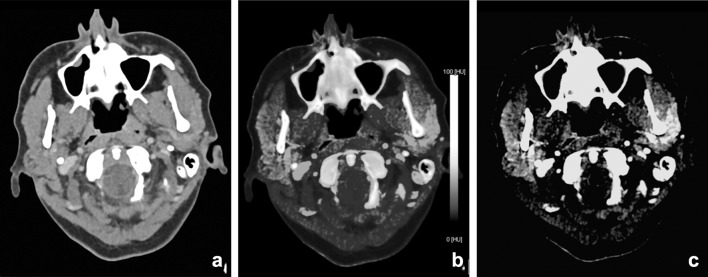 Fig. 17