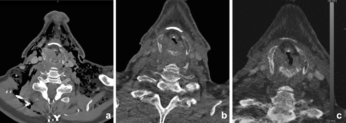 Fig. 15