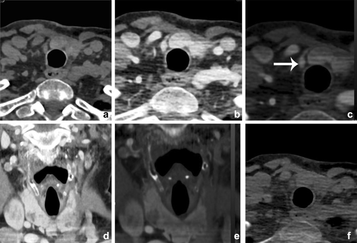 Fig. 19