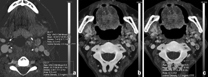 Fig. 14