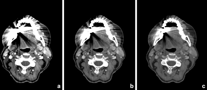 Fig. 5