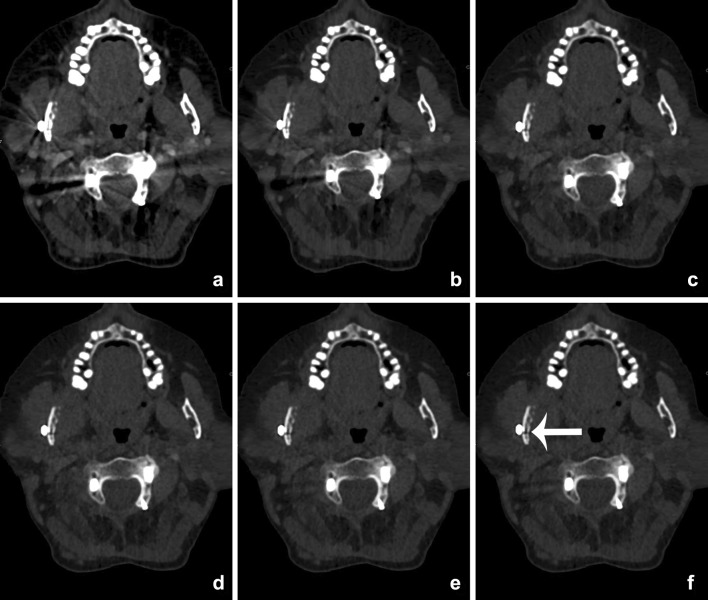 Fig. 6