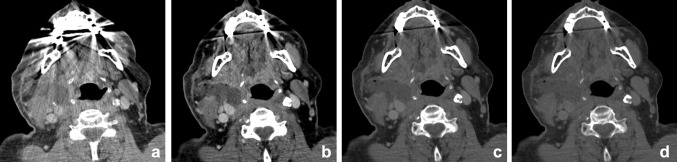 Fig. 16