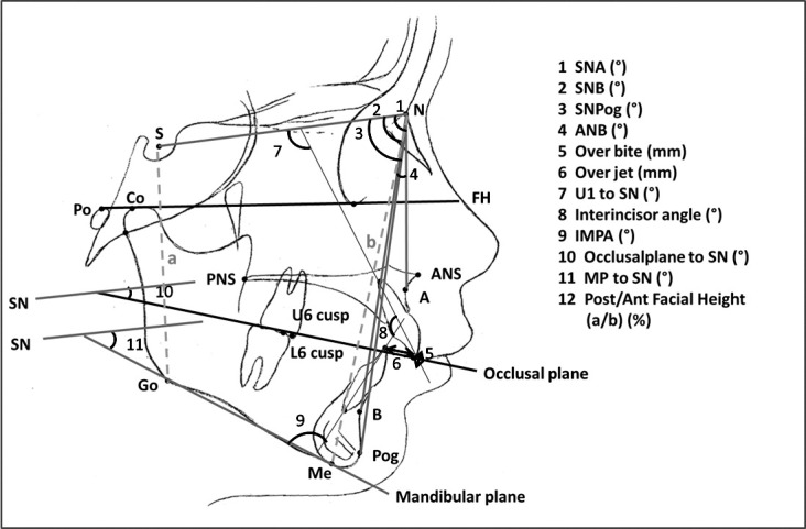 Figure 2. Cephalometric measurements.