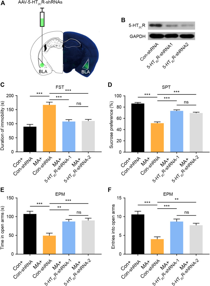 Basolateral Amygdala Serotonin 2C Receptor Regulates Emotional Disorder ...