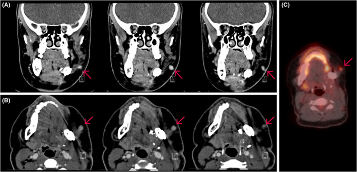 FIGURE 2