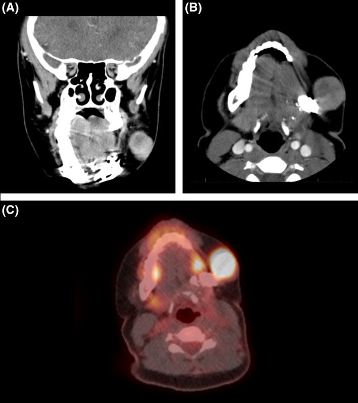 FIGURE 3