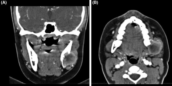 FIGURE 1