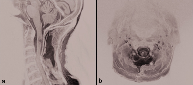 Figure 4: