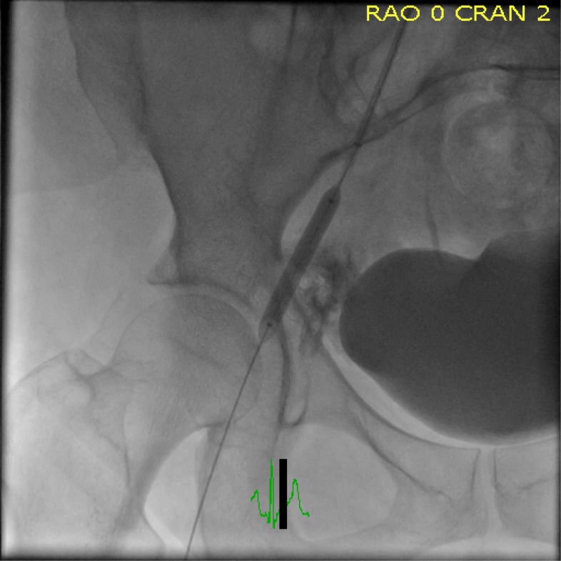 Fig. (6)