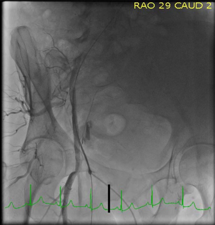 Fig. (1)